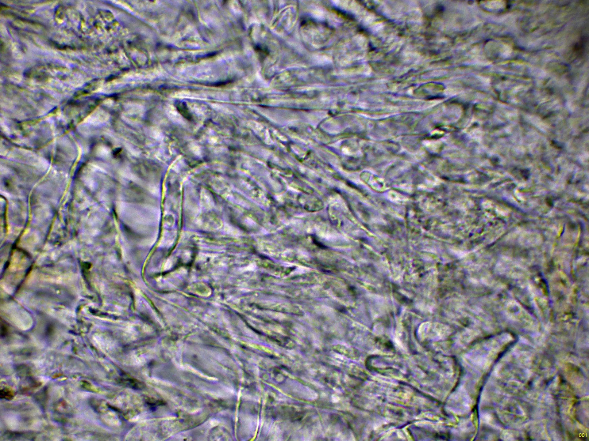 Microscopía de Leccinum holopus - 10 - Subpellis agua-001
